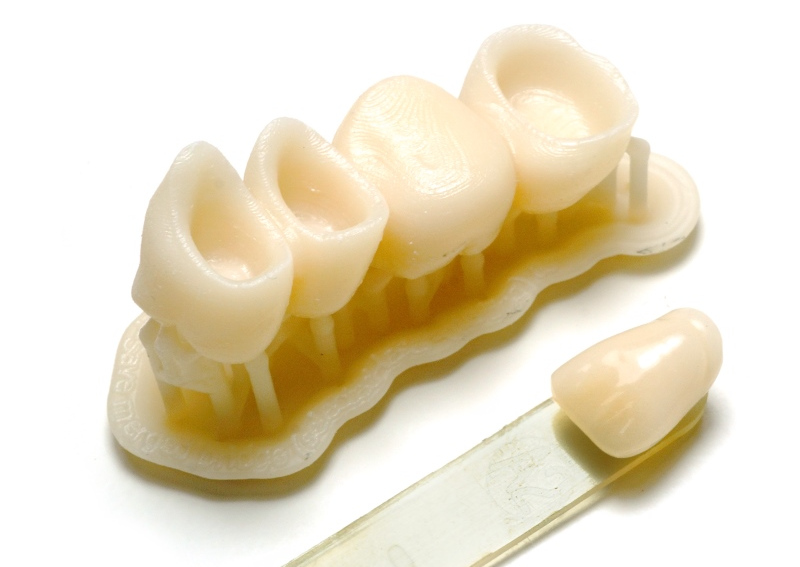 Mit HARZ Labs Dental Sand Resin gefertigte Zähne